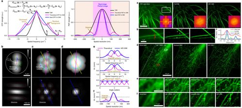蘇州醫工所結構光照明超分辨顯微成像技術研究取得系列進展
